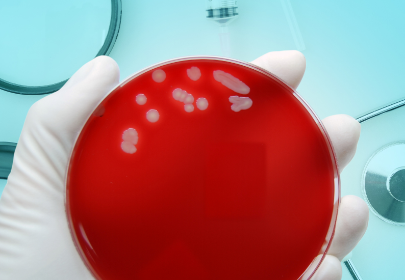 Gronkowiec złocisty (MRSA) Staphylococcus aureus 