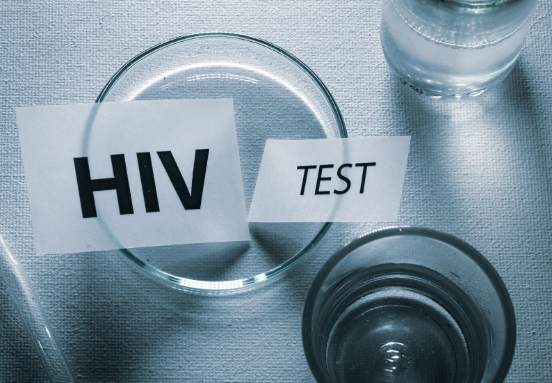 Test HIV